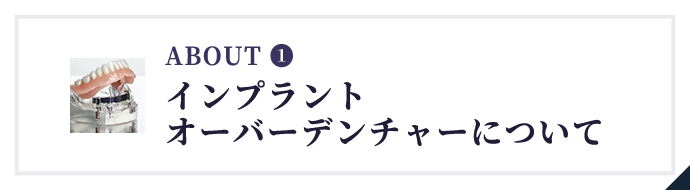 インプラントオーバーデンチャーについて