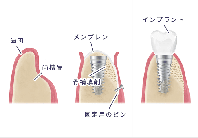 ＧＢＲ法